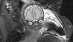 The parents tell the funny story about how the MRI picture of their son looked like an alien