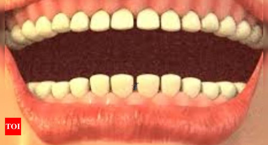 Optical Illusion: Can you spot the germ in the teeth?